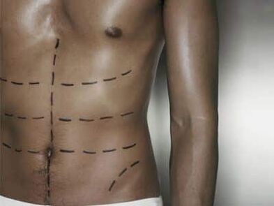 Male body
